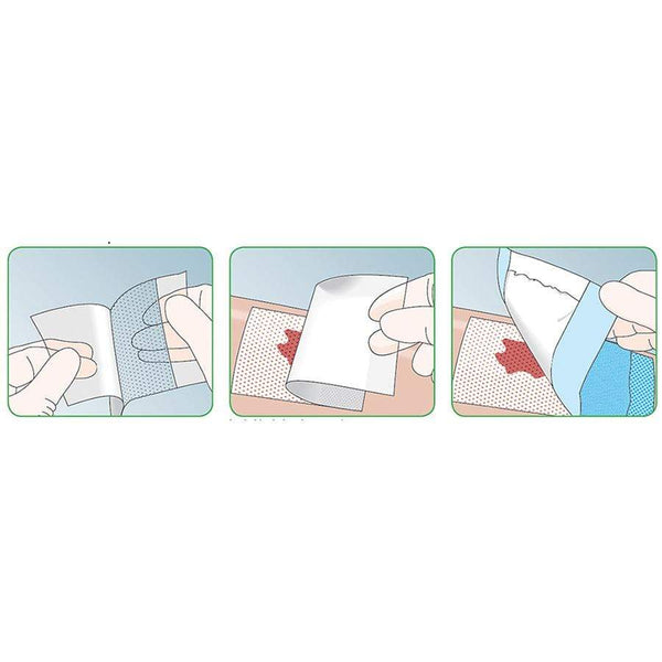 mepitel wound dressing MEPITEL WOUND DRESSING (BOX-10)
