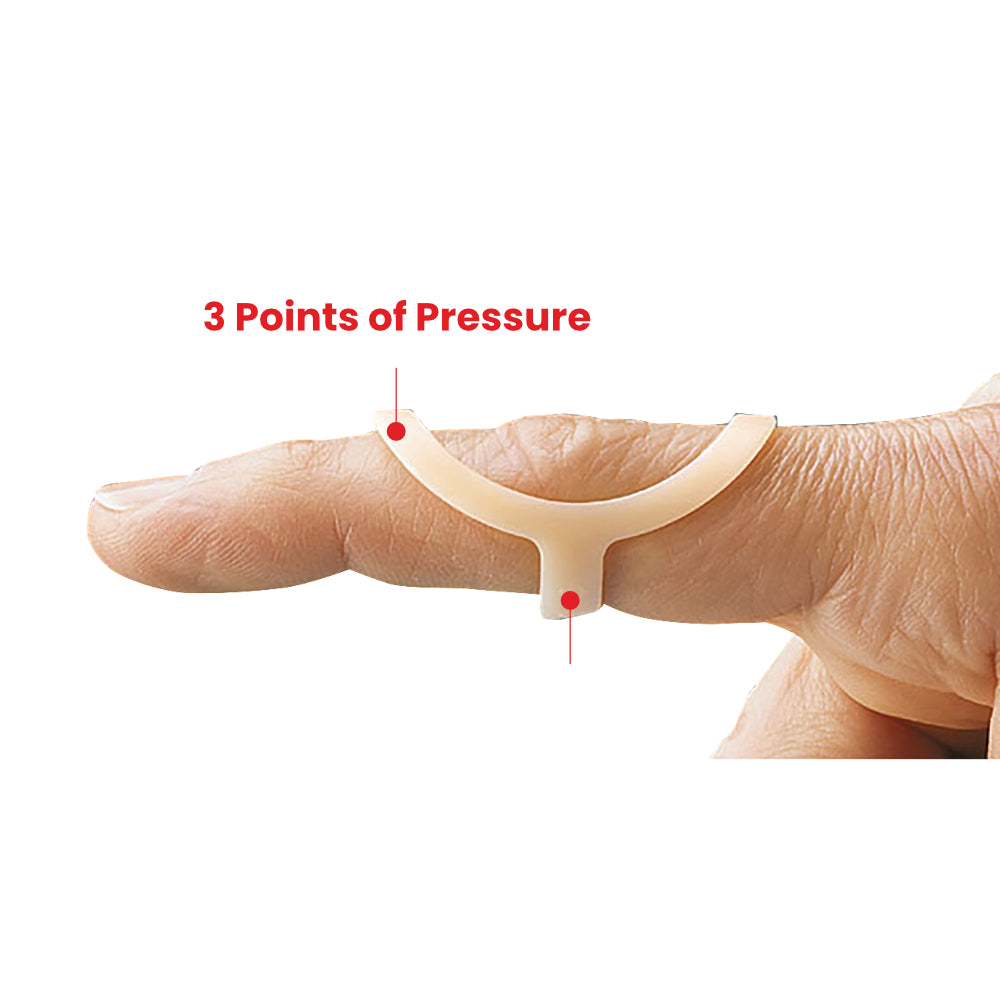 Oval 8® Finger Splints 5PK - Beige